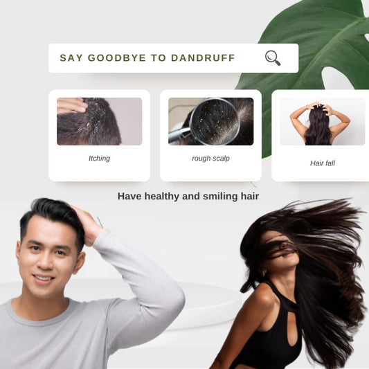 How to Get Rid of Dandruff as Per Ayurveda: Natural Remedies for Healthy Scalp