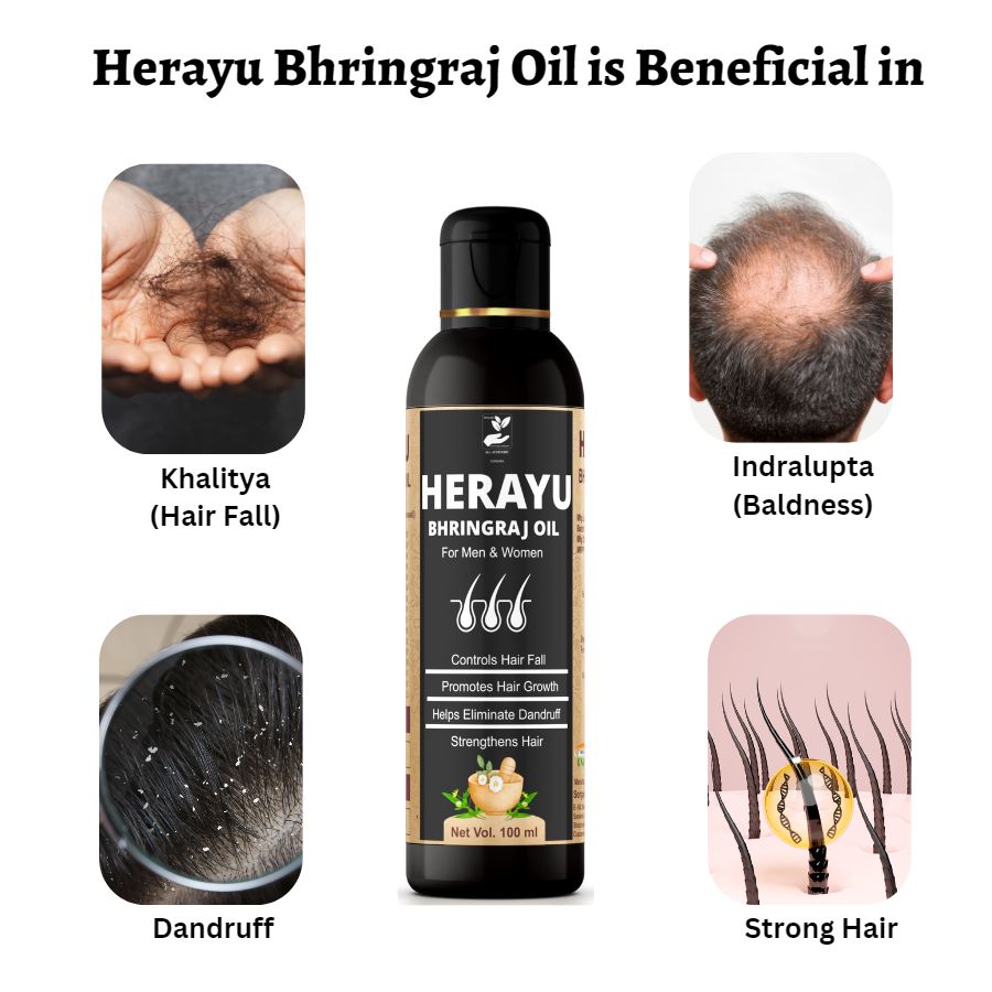 Songara Herayu Bhringraj Oil Classic (100 ml) for Hair Fall and Hair Growth